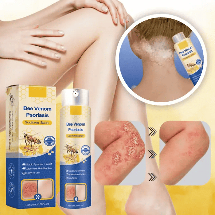 PsoriaFri spray | Omedelbar lindring av envis psoriasis