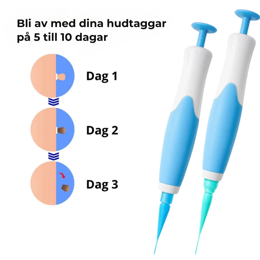 ClearSkin™ Penn – Säker borttagning av hudmärken!