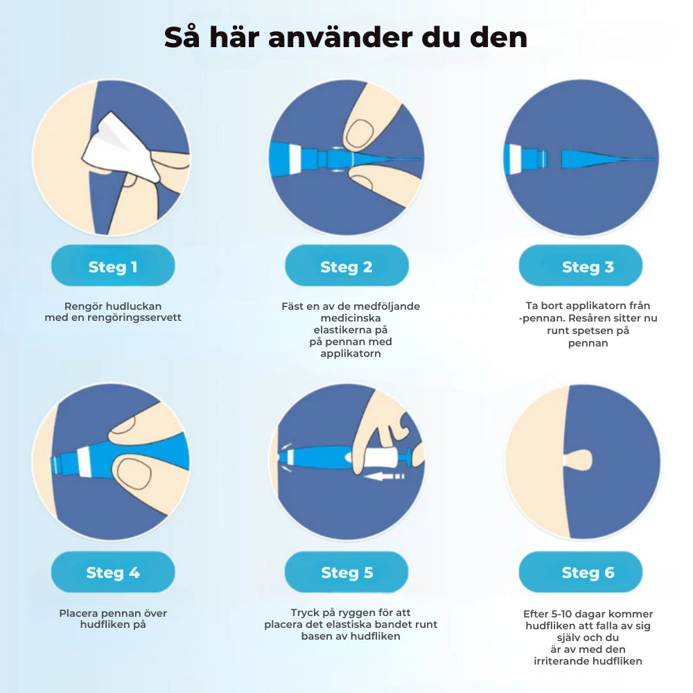 ClearSkin™ Penn – Säker borttagning av hudmärken!