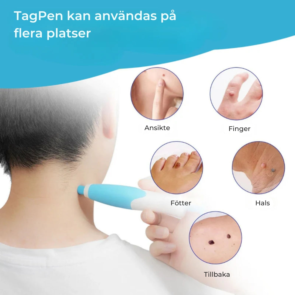 ClearSkin™ Penn – Säker borttagning av hudmärken!