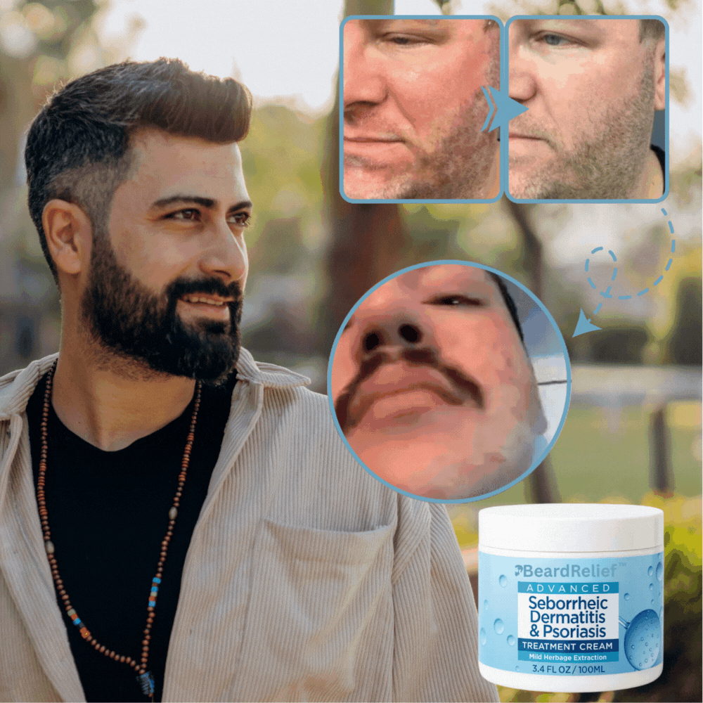 BeardCare™ | Skäggreparationskräm 1+1 GRATIS eller 2+2 GRATIS!