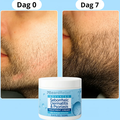 BeardCare™ | Skäggreparationskräm 1+1 GRATIS eller 2+2 GRATIS!