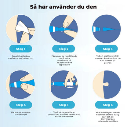 ClearSkin™ Penn – Säker borttagning av hudmärken!